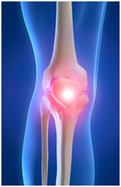 osteoarthritida osteoarthritida