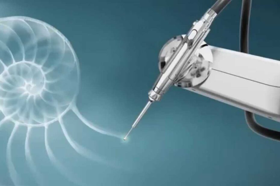 robotic arthroplasty robotikh arthroplastikh 930x620